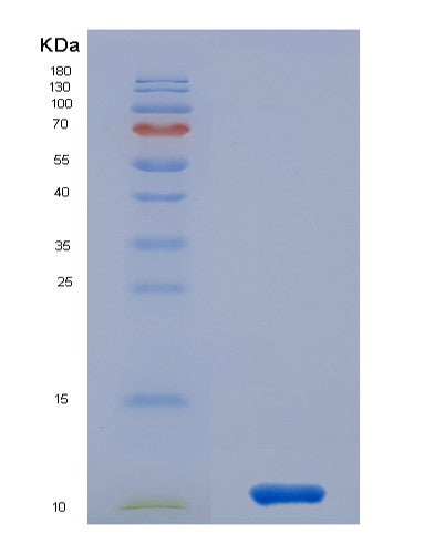 Human CCL15 (C-C Motif Chemokine 15) - Recombinant Protein