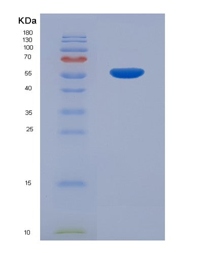 Human CDKN3 (Cyclin-Dependent Kinase Inhibitor 3) - Recombinant Protein