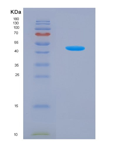 Human UPP1 (Uridine Phosphorylase 1) - Recombinant Protein