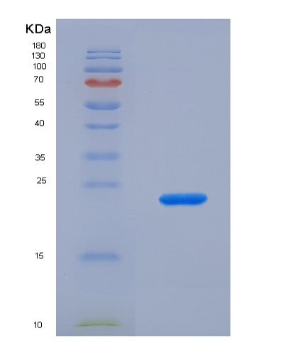 Human PTPRN (Receptor-Type Tyrosine-Protein Phosphatase-Like N) - Recombinant Protein