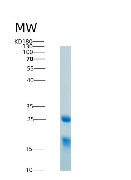 Human HMGB1 (High Mobility Group Protein B1) - Recombinant Protein