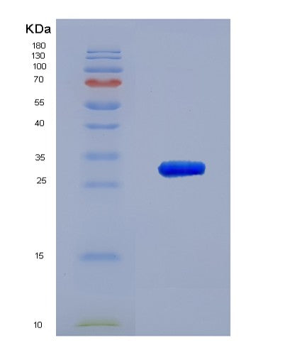 Human TXNRD1 (Thioredoxin Reductase 1, Cytoplasmic) - Recombinant Protein