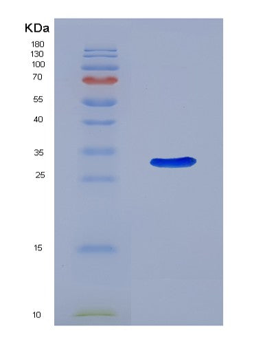 Human ABCB5 (Atp-Binding Cassette Sub-Family B Member 5) - Recombinant Protein