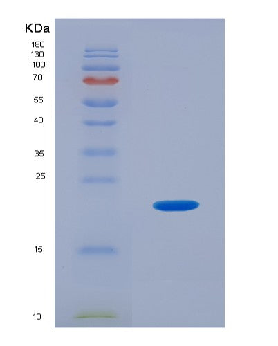 Human PHLDA2 (Pleckstrin Homology-Like Domain Family A Member 2) - Recombinant Protein