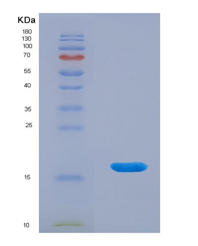 Human PLA1A (Phospholipase A1 Member A) - Recombinant Protein