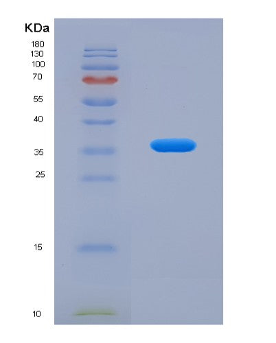 Human Pirin (PIR) - Recombinant Protein