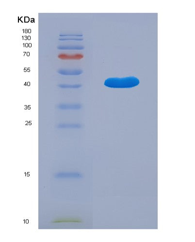 Mouse Adipoq (Adiponectin) - Recombinant Protein