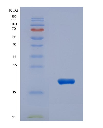 Human IL31 (Interleukin-31) - Recombinant Protein