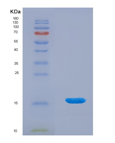 Human LAIR2 (Leukocyte-Associated Immunoglobulin-Like Receptor 2) - Recombinant Protein