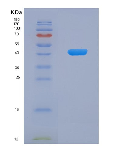 Human JMJD6 (Bifunctional Arginine Demethylase And Lysyl-Hydroxylase Jmjd6) - Recombinant Protein
