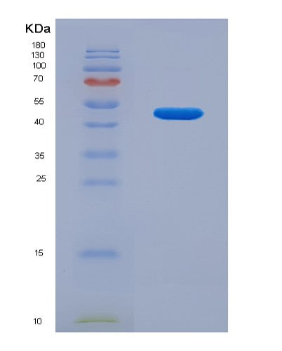 Human AAGAB (Alpha- And Gamma-Adaptin-Binding Protein P34) - Recombinant Protein