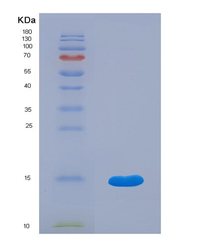 Human EPGN (Epigen) - Recombinant Protein