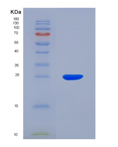 Human ANGPTL8 (Angiopoietin-Like Protein 8) - Recombinant Protein