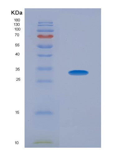Human IL34 (Interleukin-34) - Recombinant Protein