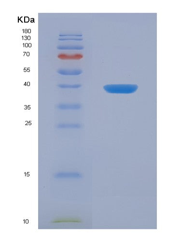 Human ARC (Activity-Regulated Cytoskeleton-Associated Protein) - Recombinant Protein