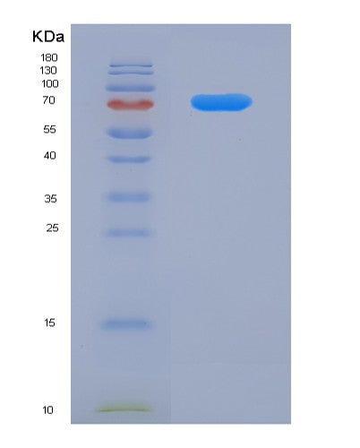 Human MAVS (Mitochondrial Antiviral-Signaling Protein) - Recombinant Protein