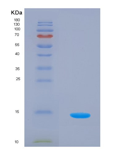 Human VTCN1 (V-Set Domain-Containing T-Cell Activation Inhibitor 1) - Recombinant Protein