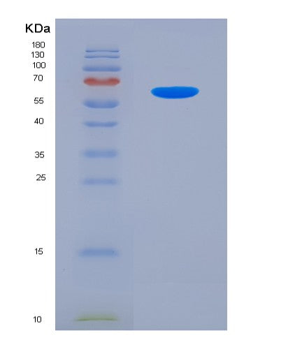 Human PEX26 (Peroxisome Assembly Protein 26) - Recombinant Protein
