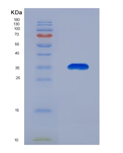Human PPP1R3B (Protein Phosphatase 1 Regulatory Subunit 3B) - Recombinant Protein