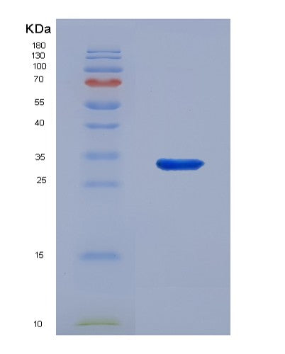 Human TICAM2 (Tir Domain-Containing Adapter Molecule 2) - Recombinant Protein