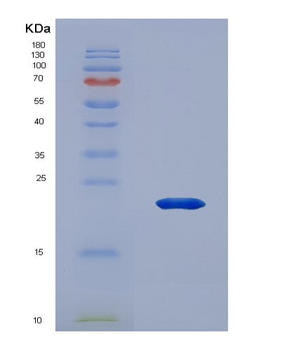 Human PDPN (Podoplanin) - Recombinant Protein