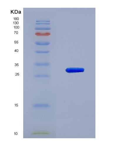 Human Guanine Monophosphate Synthetase (GMPS) - Recombinant Protein