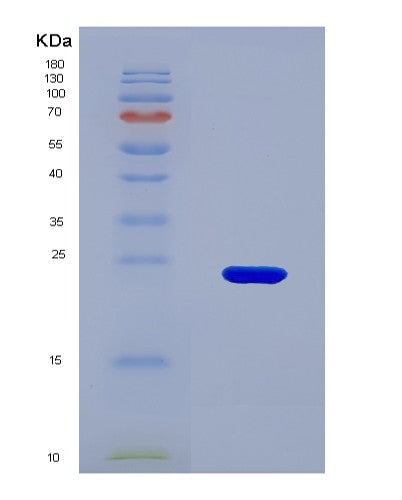 Human TPH2 (Tryptophan 5-Hydroxylase 2) - Recombinant Protein