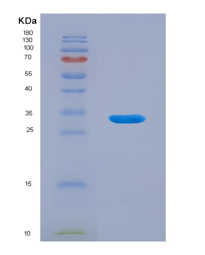 Human TMEFF1 (Tomoregulin-1) - Recombinant Protein