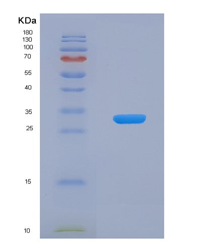 Human CA13 (Carbonic Anhydrase 13) - Recombinant Protein