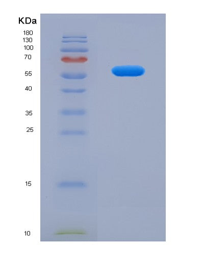 Human GOLM1 (Golgi Membrane Protein 1) - Recombinant Protein