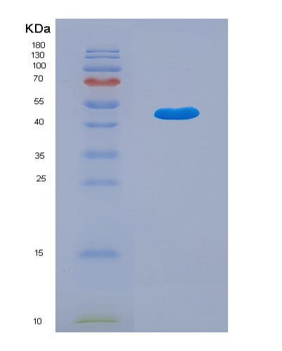 Human LPCAT1 (Lysophosphatidylcholine Acyltransferase 1) - Recombinant Protein