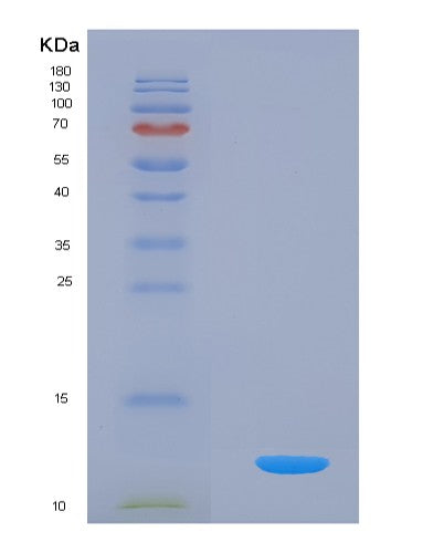 Human GPT2 (Alanine Aminotransferase 2) - Recombinant Protein