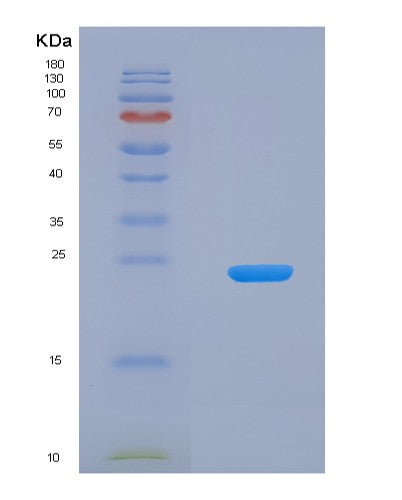 Human HAVCR2 (Hepatitis A Virus Cellular Receptor 2) - Recombinant Protein