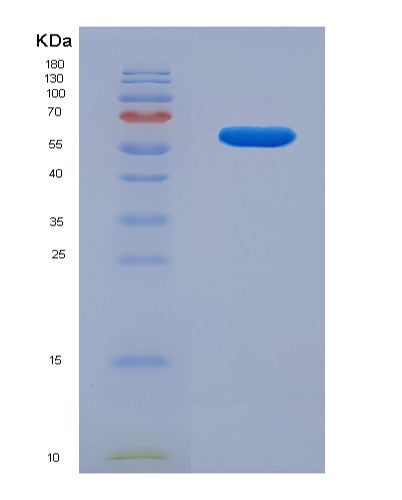 Human TCP1 (T-Complex Protein 1 Subunit Alpha) - Recombinant Protein