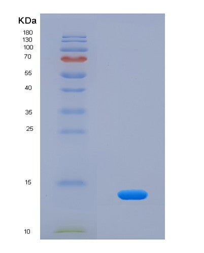 Human DEFB104A (Beta-Defensin 104) - Recombinant Protein