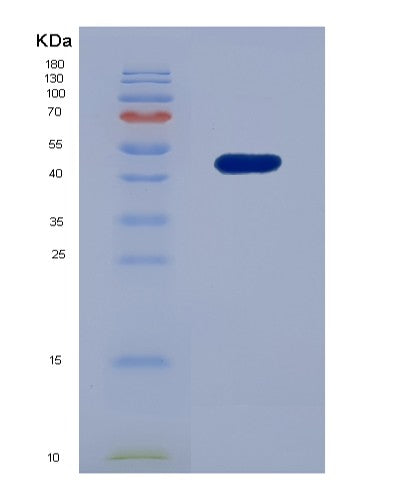 Human PDCD6IP (Programmed Cell Death 6-Interacting Protein) - Recombinant Protein