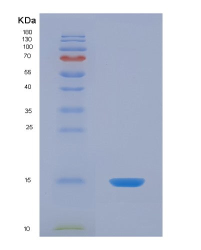 Human S100Z (Protein S100-Z) - Recombinant Protein