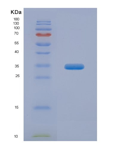 Mouse Adipor1 (Adiponectin Receptor Protein 1) - Recombinant Protein