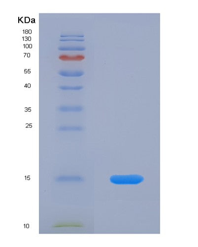Human HSPH1 (Heat Shock Protein 105 Kda) - Recombinant Protein