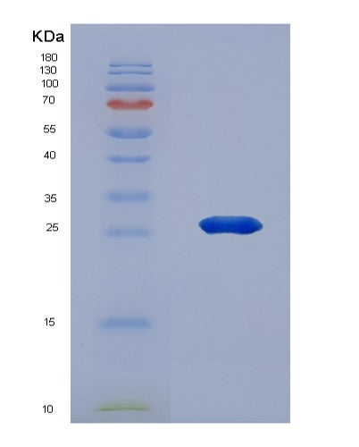 Human KAT2A (Histone Acetyltransferase Kat2A) - Recombinant Protein