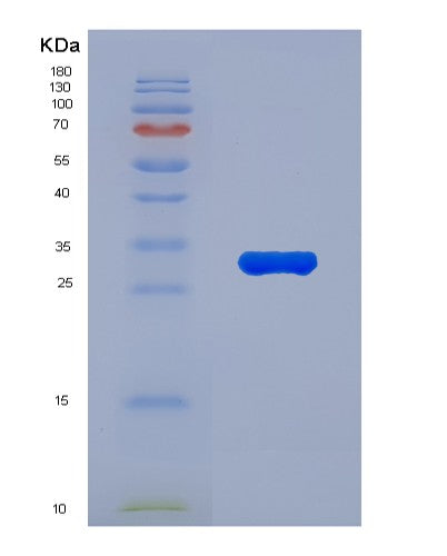 Human CASP10 (Caspase-10) - Recombinant Protein