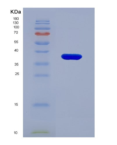 Human PMM1 (Phosphomannomutase 1) - Recombinant Protein