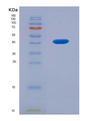 Human STMN2 (Stathmin-2) - Recombinant Protein
