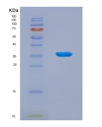 Human BHMT (Betaine--Homocysteine S-Methyltransferase 1) - Recombinant Protein