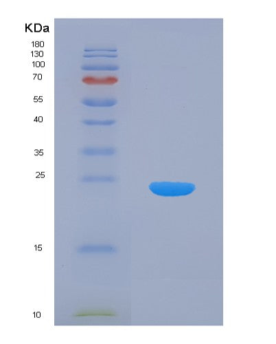 Human PTP4A1 (Protein Tyrosine Phosphatase Type Iva 1) - Recombinant Protein
