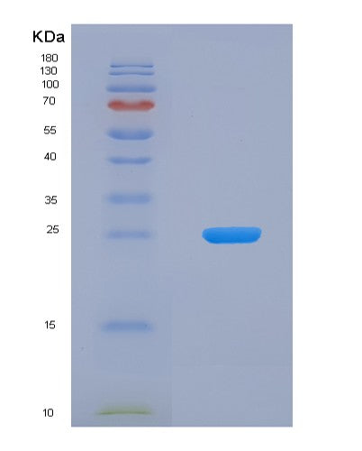 Human CSN2 (Beta-Casein) - Recombinant Protein