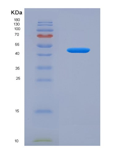 Human RFK (Riboflavin Kinase) - Recombinant Protein