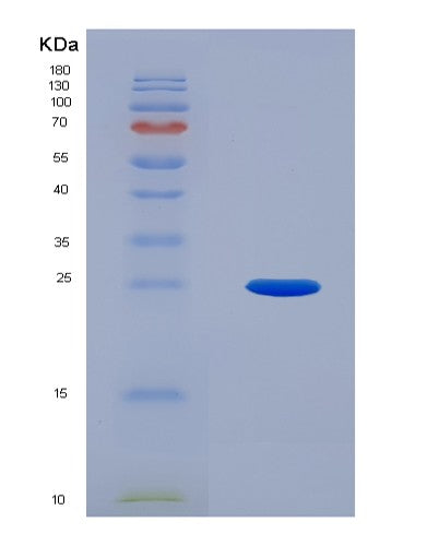 Human UBE2F (Nedd8-Conjugating Enzyme Ube2F) - Recombinant Protein