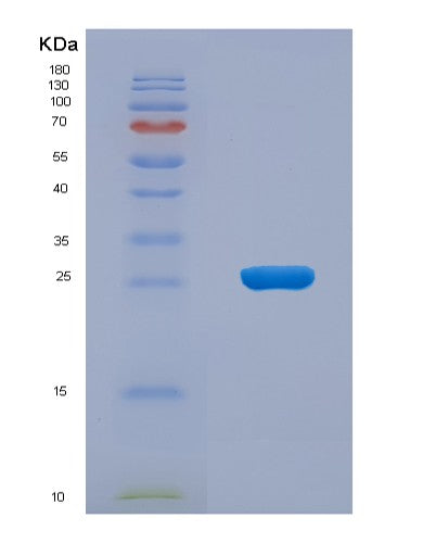 Human PPCDC (Phosphopantothenoylcysteine Decarboxylase) - Recombinant Protein