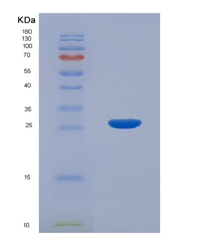 Human CTHRC1 (Collagen Triple Helix Repeat-Containing Protein 1) - Recombinant Protein